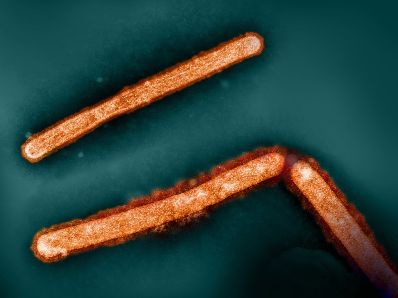 Microscopic image of rod-shaped virus particles in a dark field. The particles are elongated and glowing orange against a teal background.